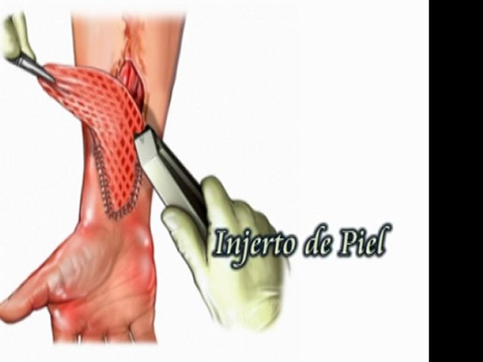 CÁMARA HIPERBÁRICA PERÚ. Usos médicos de camara hiperbarica http://camarahiperbaricaperu.blogspot.com/