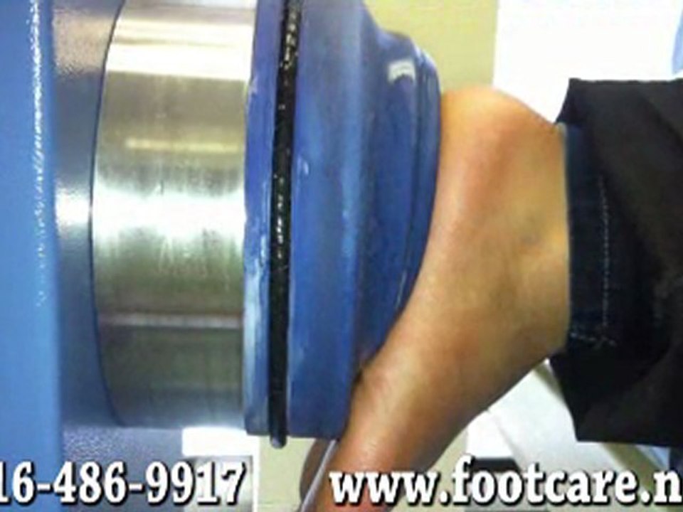 Extracorporeal Shock Wave Therapy - Toronto, ON - Podiatrist, foot Doctor of Podiatric Medicine, Foot Specialist