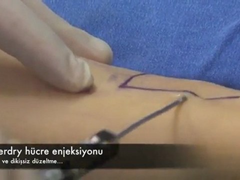 Ayak Bileği Estetiği - Ahmet Karacalar Prof.Dr.