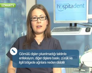 Gomulu dislerin cekilmesi icin hangi yontemlere basvurulur