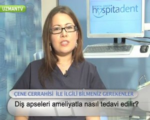 Apseli diş nasıl tedavi edilir?-Fulya Özbey Erkılıç