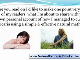 chronic idiopathic urticaria - urticaria causes - dermatographic urticaria