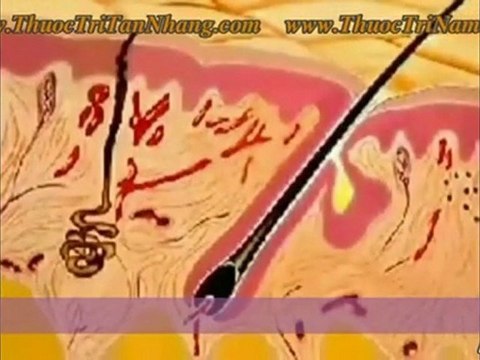 Điều trị nám da hiệu quả nhất từ thiên nhiên 4