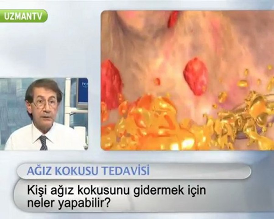Ağız kokusunu gidermek için ne yapmalıyım?-Murat Aydın
