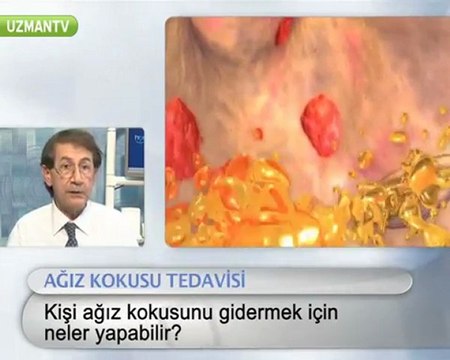 Ağız kokusunu gidermek için ne yapmalıyım?-Murat Aydın