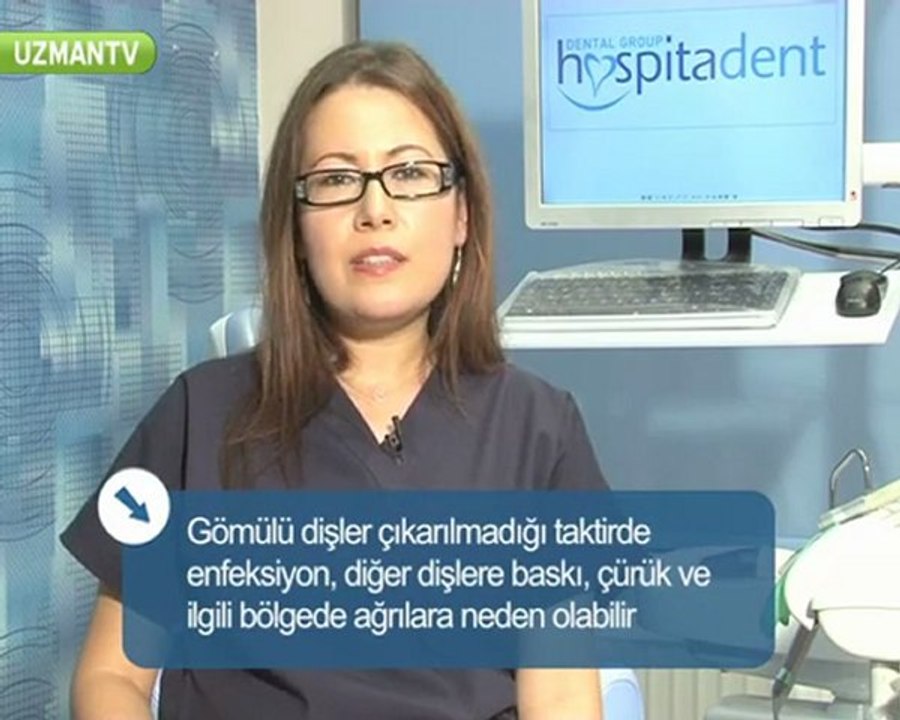 Gömülü diş nasıl çekilir?-Fulya Özbey Erkılıç