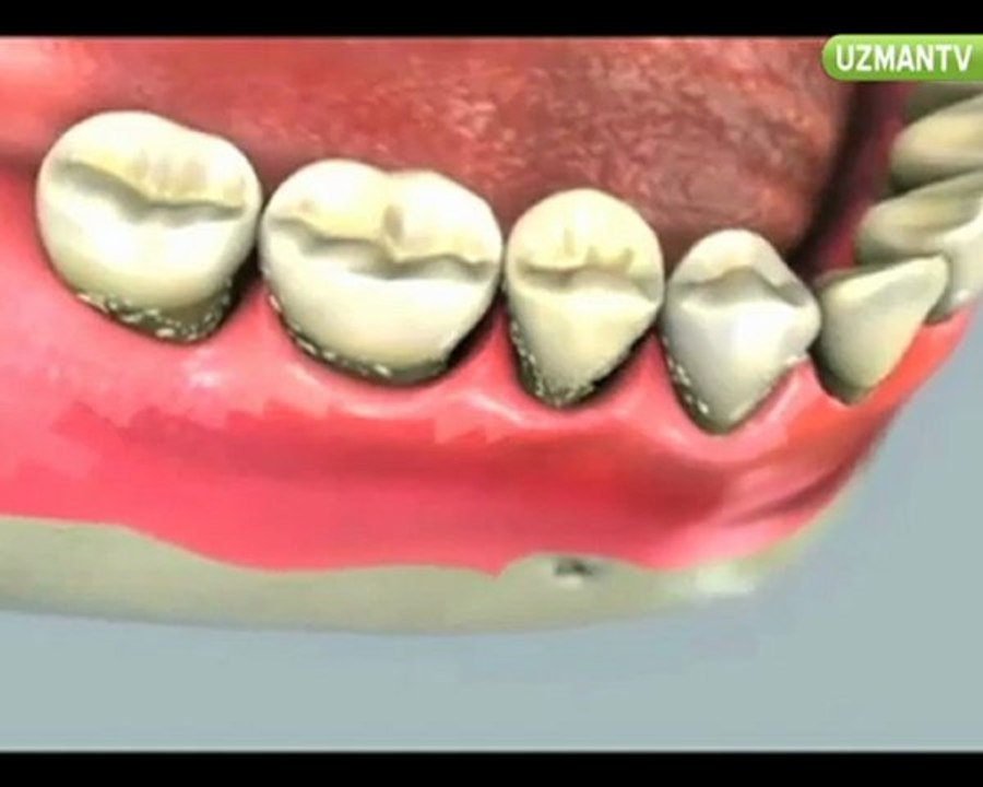 Diş eti sorunları nelerdir?-Nazlı Menemencioğlu