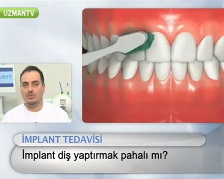 İmplant,çakma diş pahalı mıdır?-Serkan Tüzün