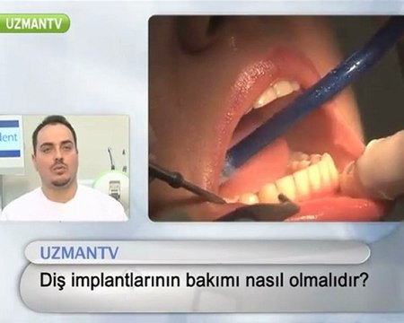 implant(vidalı) dişlerin bakımı nasıl olmalıdır?-Serkan Tüzün