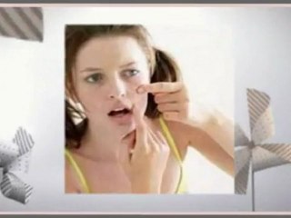 Best Treatment for Acne Scars