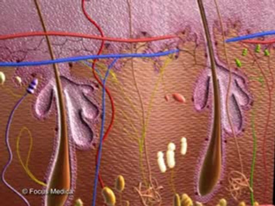 Abscess (Animated Pocket Dictionary_ Infectious Diseases)