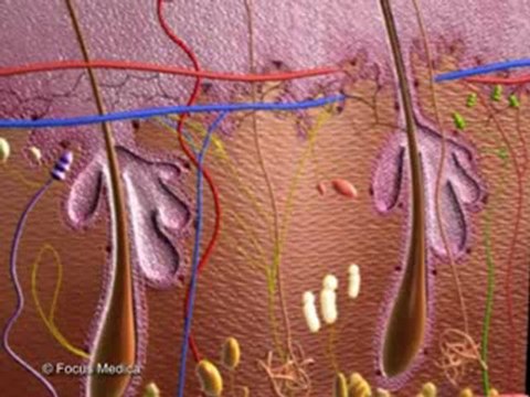 Abscess (Animated Pocket Dictionary_ Infectious Diseases)