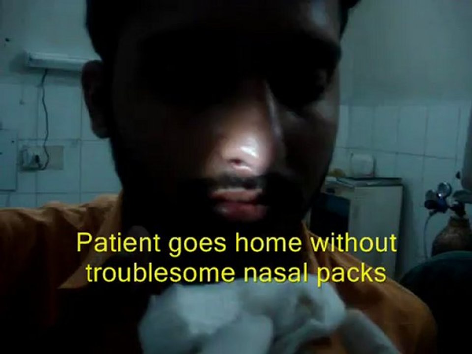 Dr Arfat Jawaid's technique of septoplasty without packing