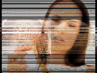 Haartransplantation Schweiz