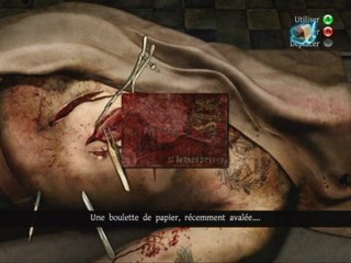 Le testament de Sherlock Holmes - l'autopsie de Kurtz