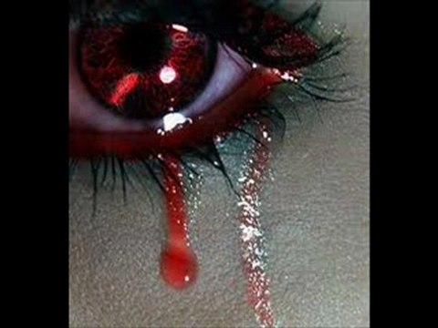 trpikolik-by furkan dereli-gözleri varya