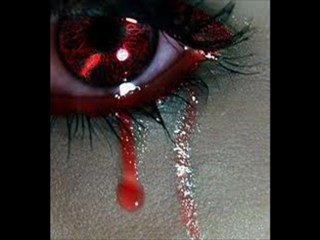 trpikolik-by furkan dereli-gözleri varya