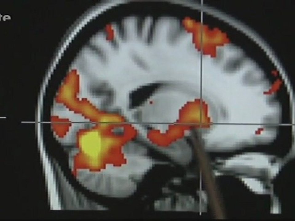 Jeûner bon pour santé (Xenius) -