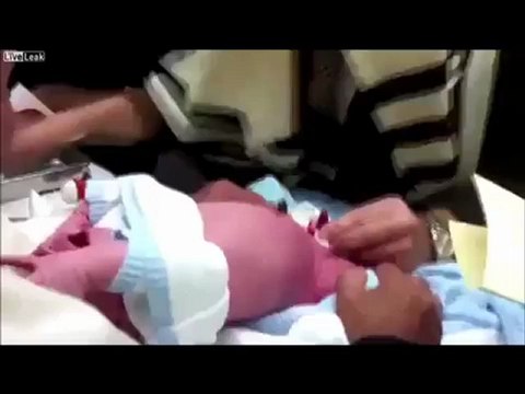 La circoncision d'après le Talmud.Horrible!