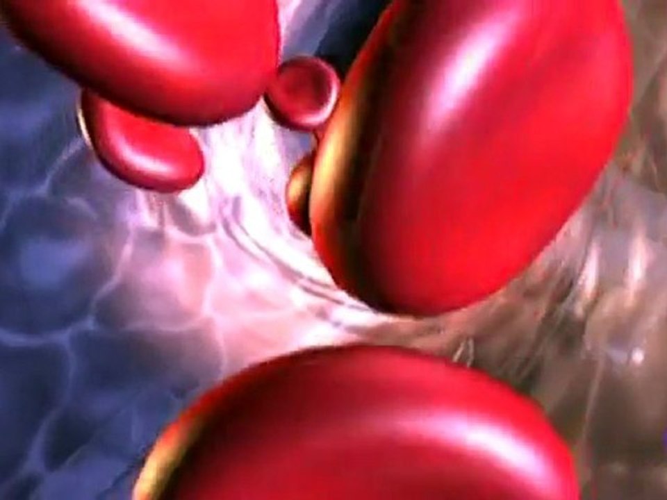 Aterosclerosis: Celulas madre