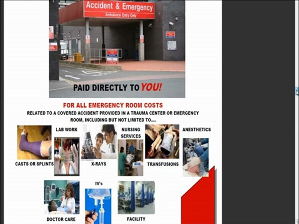 What Is MCA ? How Does MCA Work