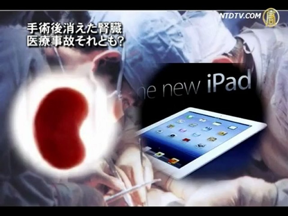 手術後消えた腎臓 医療事故それとも？