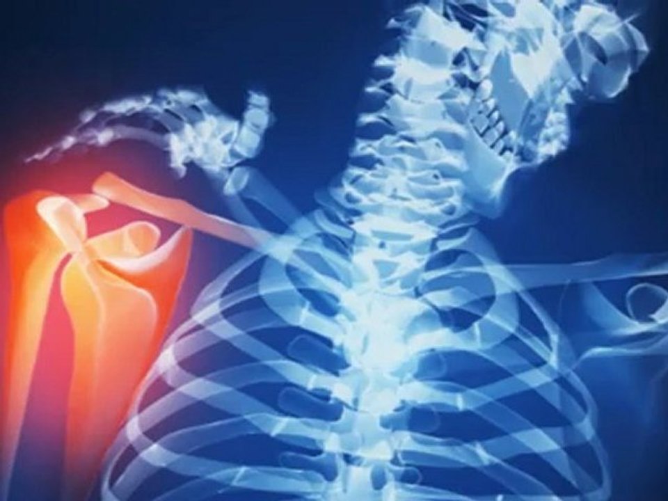 Magnetoterapia, fisioterapia para el tratamiento de esguinces.