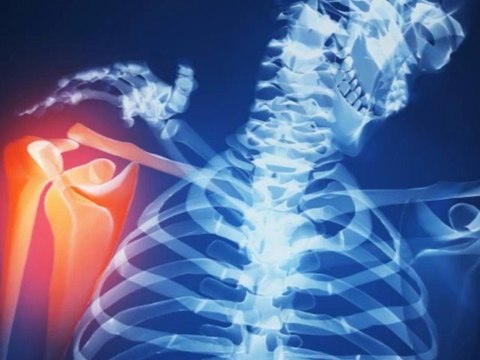 Magnetoterapia, tratamiento dolor de cervicales con magnetoclinic