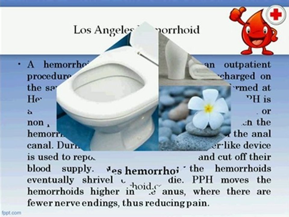 Benefits Of Hemorrhoid Surgery