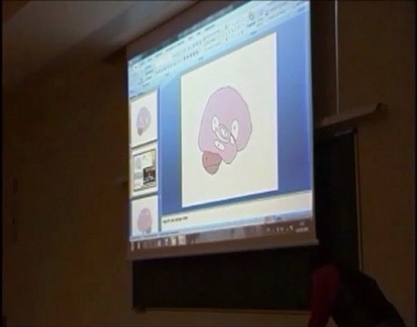 Neurologia 01 - En busca de las areas musicales - Prof Manuel Lafarga