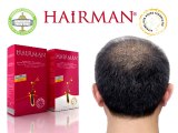 Saç Dökülmesi-Saç Çıkartıcı-Hairman
