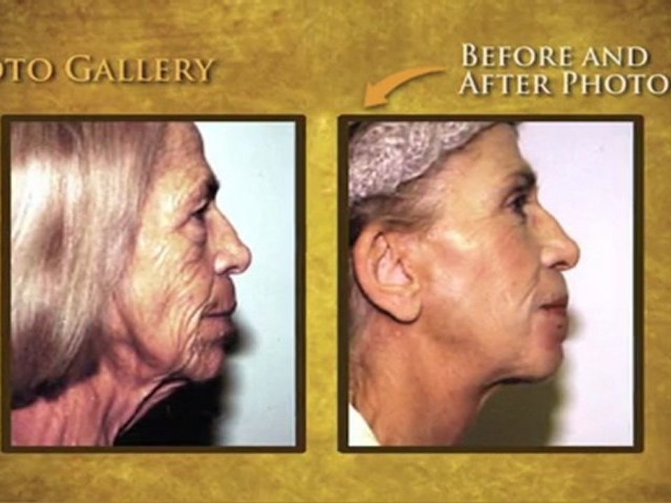 San Diego Plastic Surgeons - Dr. William Umansky and Dr. Jeffrey Umansky