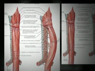 Eosinophilic Esophagitis EoE or EE