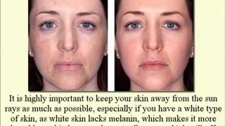Skin Whitening Natural Products--[ Between Beauty and Health]