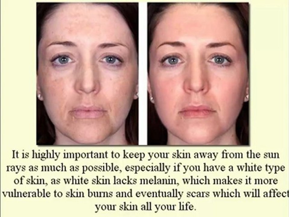 Skin Whitening Natural Products--[ Between Beauty and Health]