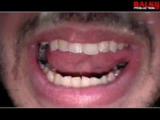 Psy 4 De La Rime- Danger Clip