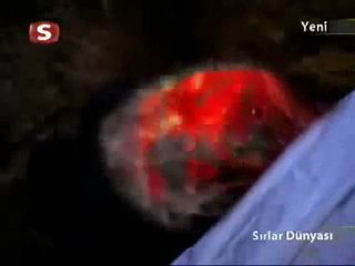 DUA EDERKEN DiKKAT ET-2