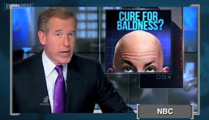 New Study Shows Possible Cure for Baldness