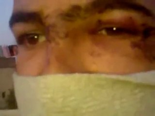 فري برس  حماه المحتلة قسطون تعذيب أحد المتظاهرين 2012 3 23