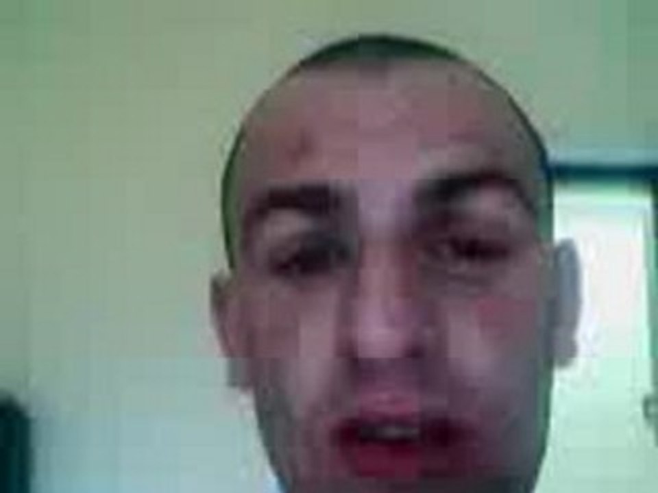 oedeme de quinck