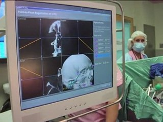 Greffe spectaculaire du visage aux Etats-Unis