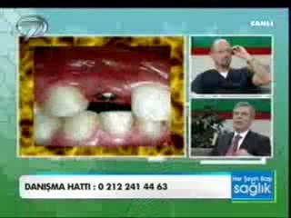 implant Nedir? Tedavi Nasıl Gerçekleştirilir?