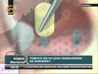 Türkiye Diş ve Çene Cerrahisinde Ne Durumda?