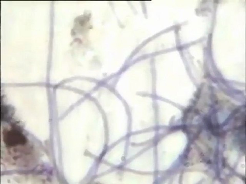 Observation de lames de boues activées de Rio Anqueil (site de Vaux-le-Vicomte) au microscope