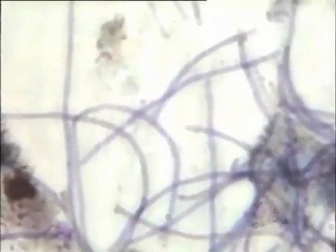 Observation de lames de boues activées de Rio Anqueil (site de Vaux-le-Vicomte) au microscope