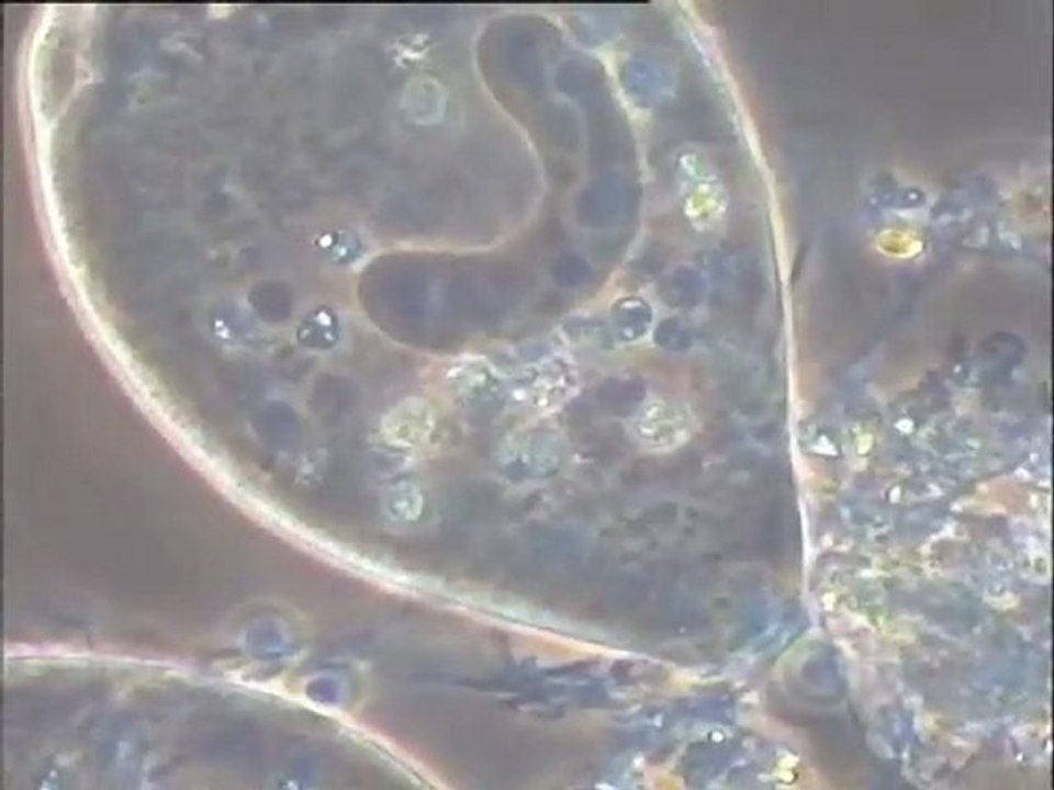Observation de prélèvements de biomasses du pilote de Valenton