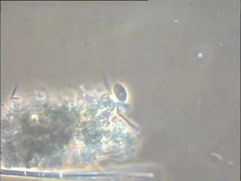 Examen des eaux de lavage du Biofor