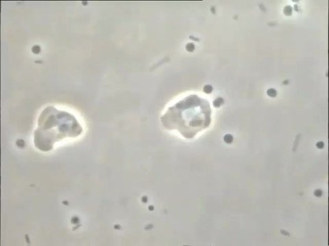 Prélèvement de Colombes : microfaune des flocs à fort grossissement - prédation par amibes