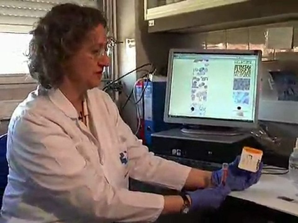 ¿Sabes como se diagnostican enfermedades como la Malaria? Descúbrelo en este vídeo