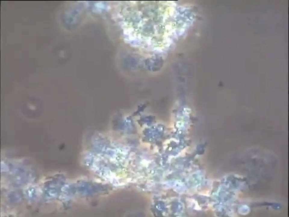 Examen des boues activées de la station de Donges (bassin D11 A)